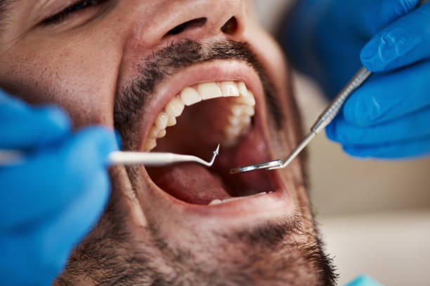 Best Broken or Chipped Tooth Repair in Lakeland, FL